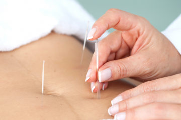 Acupuncture Claygate Clinic